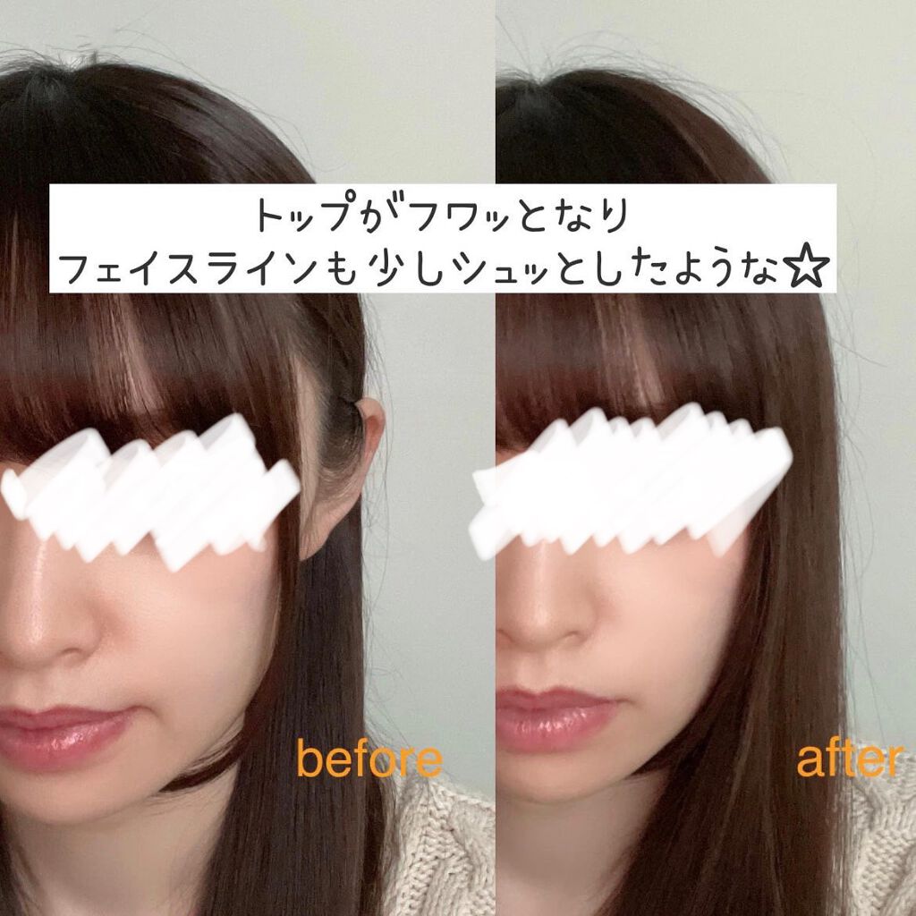 ルメント ヘッドスパ/Le ment/ヘッドマッサージャーを使ったクチコミ（3枚目）