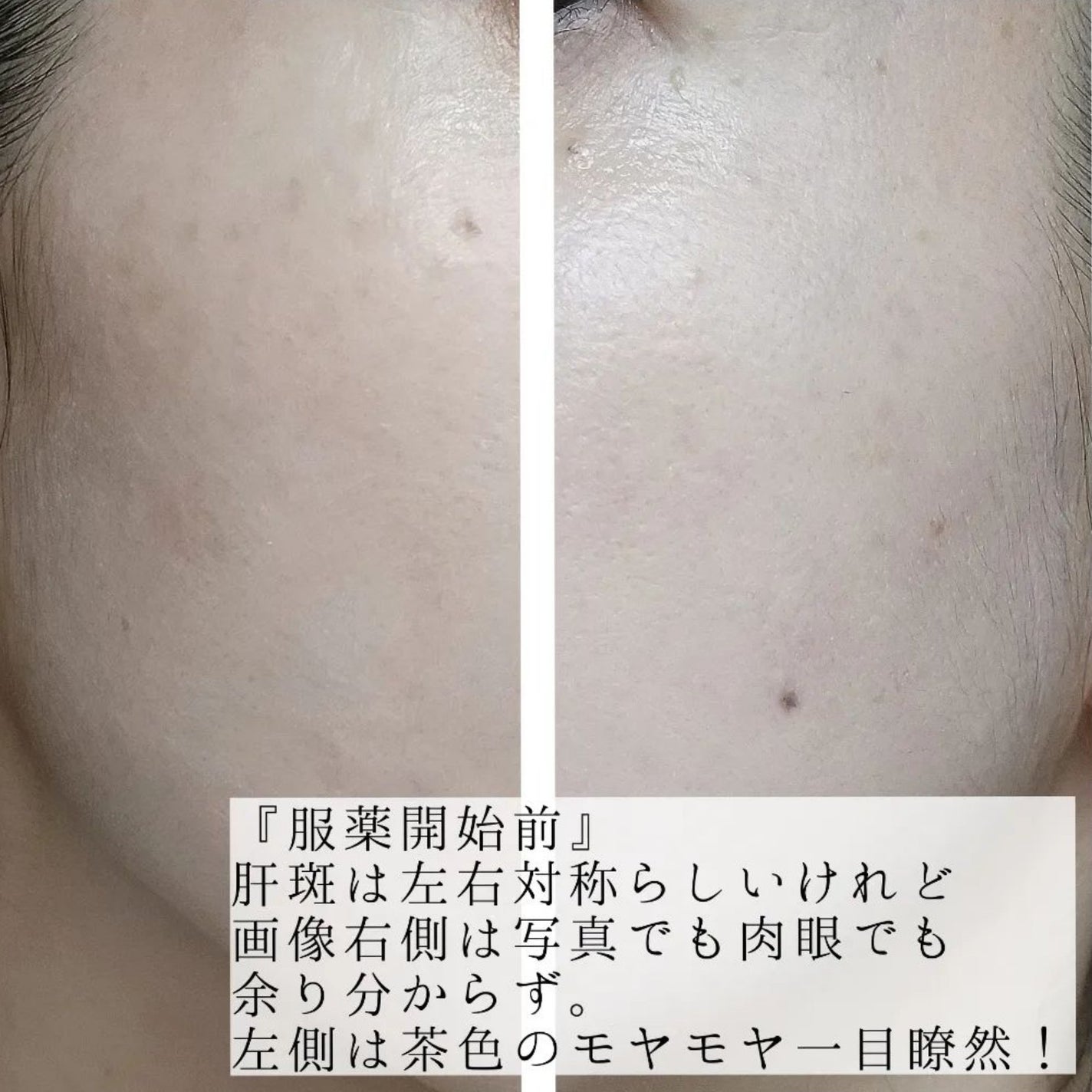 ハイドロクリームPHQ-5/KISO/フェイスクリームを使ったクチコミ(4枚目)