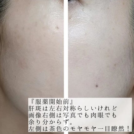 ハイドロクリームPHQ-5/KISO/フェイスクリームを使ったクチコミ(4枚目)