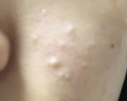 を使ったクチコミ(1枚目)