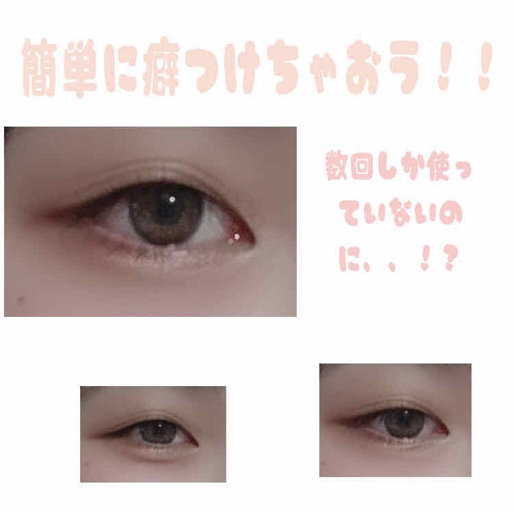 アイトーク/アイトーク/二重まぶた用アイテムを使ったクチコミ(1枚目)