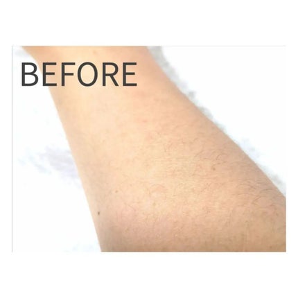 薬用ブラックリムーバー/RODOMIS/除毛クリームを使ったクチコミ(4枚目)