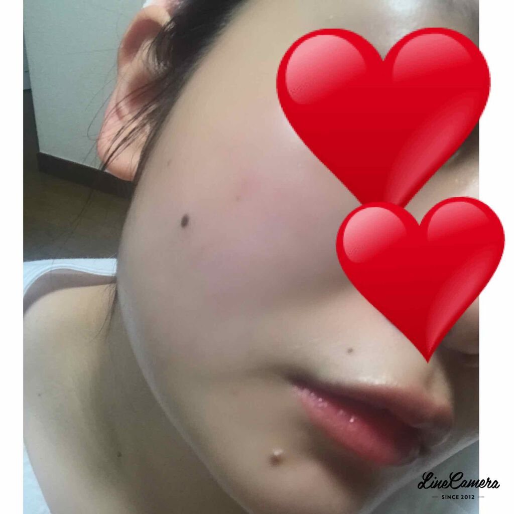 スーパーホワイト377VC/ドクターシーラボⓇ/美容液を使ったクチコミ(3枚目)