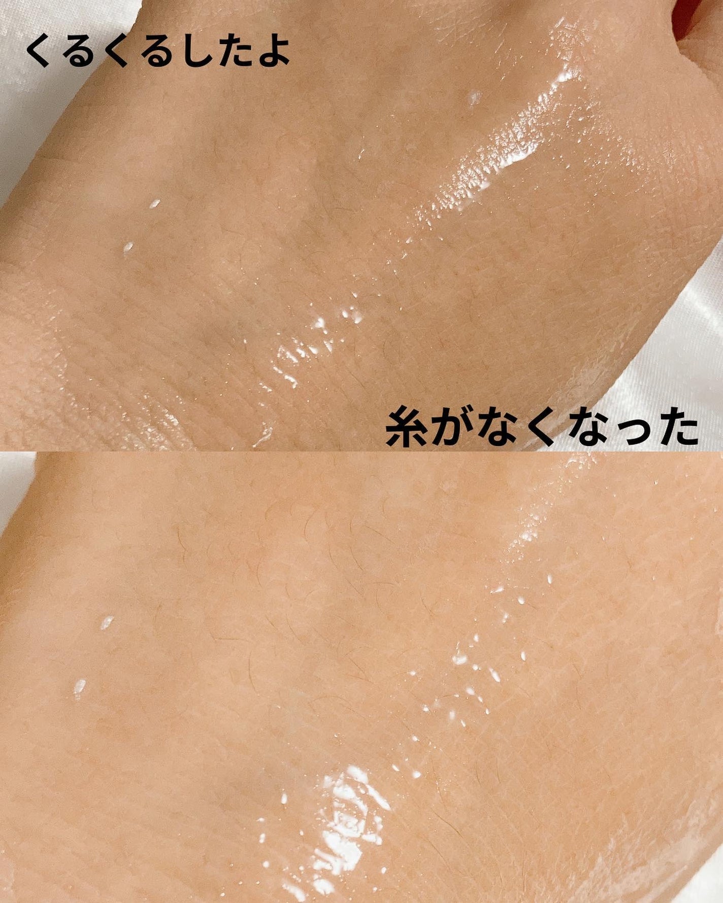 エイジホールディングペプタトックスアンプル/BYLIMU/美容液を使ったクチコミ(5枚目)