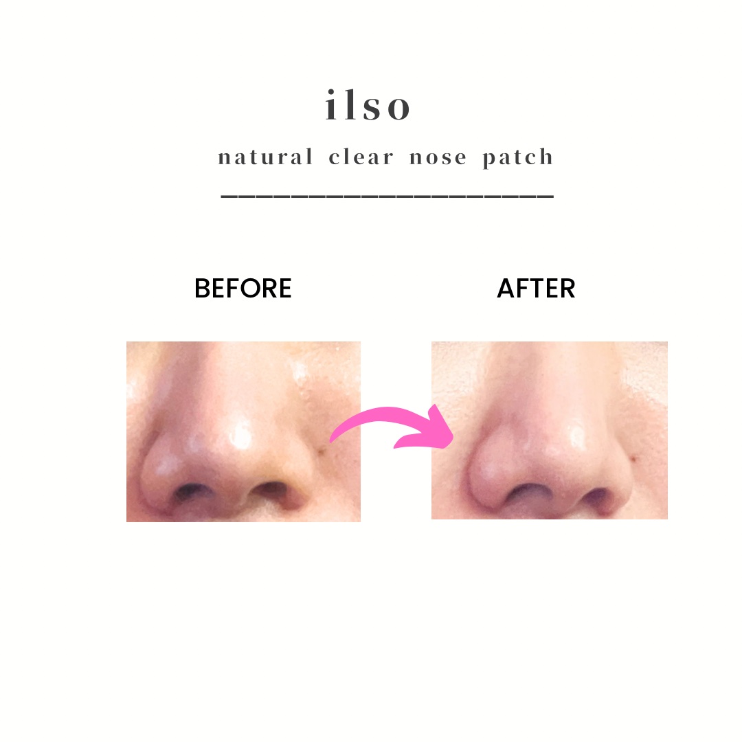 ディープクリーンマスター/ilso/その他スキンケアグッズを使ったクチコミ（3枚目）