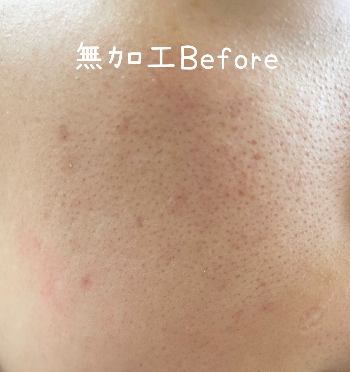 薬用 しみ 集中対策 美容液/メラノCC/美容液を使ったクチコミ(2枚目)