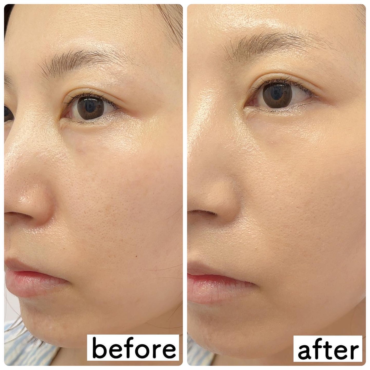 F5 リフレッシュクッション/keybo/クッションファンデーションを使ったクチコミ(5枚目)