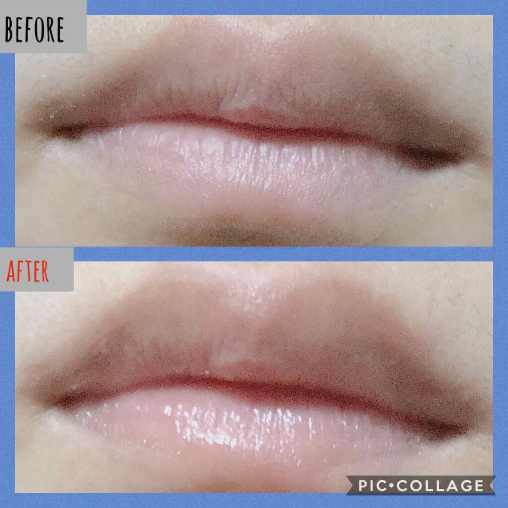 リッププランパーエクストラセラム/Borica/リッププランパーを使ったクチコミ(3枚目)