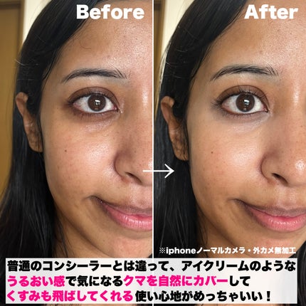 アイレノール クマクリーム/IRENOL/アイケア・アイクリームを使ったクチコミ(6枚目)