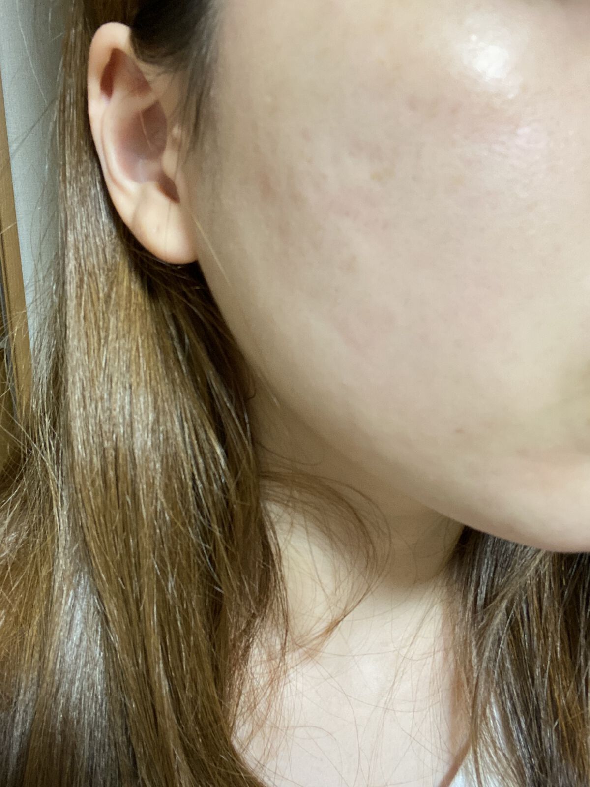 ナチュラボ 生ハーブピーリング/石澤研究所/ピーリングを使ったクチコミ（2枚目）