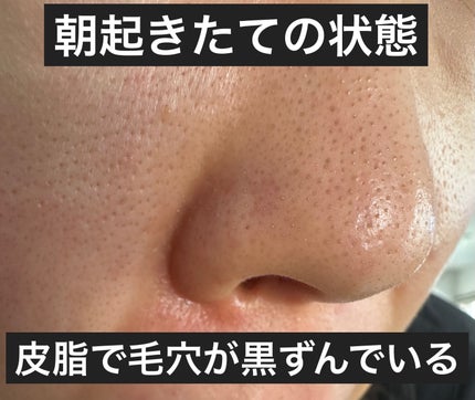 マイルドクレンジング オイル〈ブラック&スムース〉/ファンケル/オイルクレンジングを使ったクチコミ(5枚目)