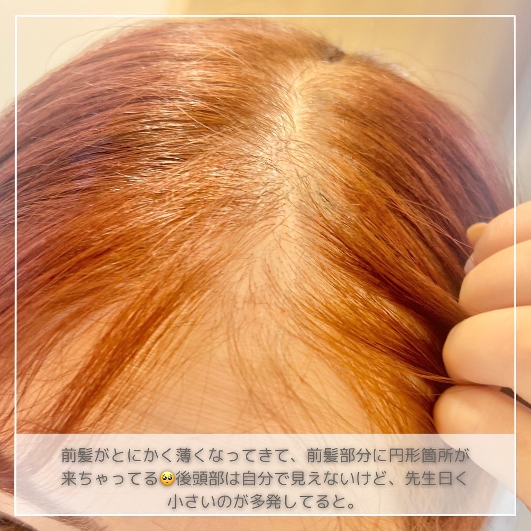 コンパクトスタイラー/TANGLE TEEZER/ヘアブラシを使ったクチコミ(3枚目)