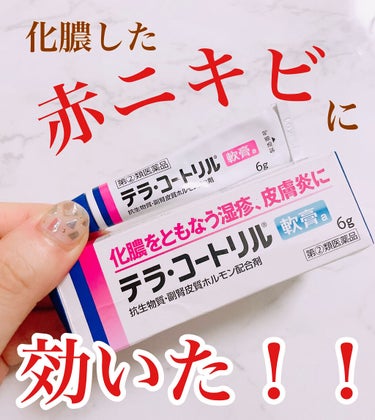 テラ・コートリル 軟膏(医薬品)/ジョンソン・エンド・ジョンソン/その他を使ったクチコミ（1枚目）