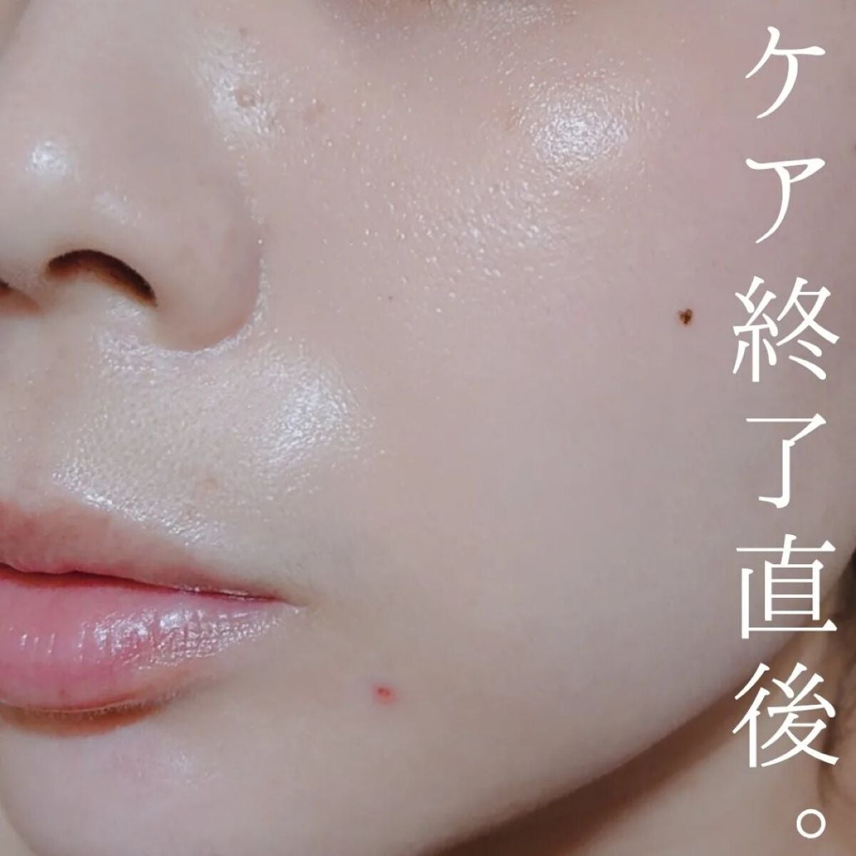 アクアピールクリア/TBC/美顔器・マッサージを使ったクチコミ(10枚目)