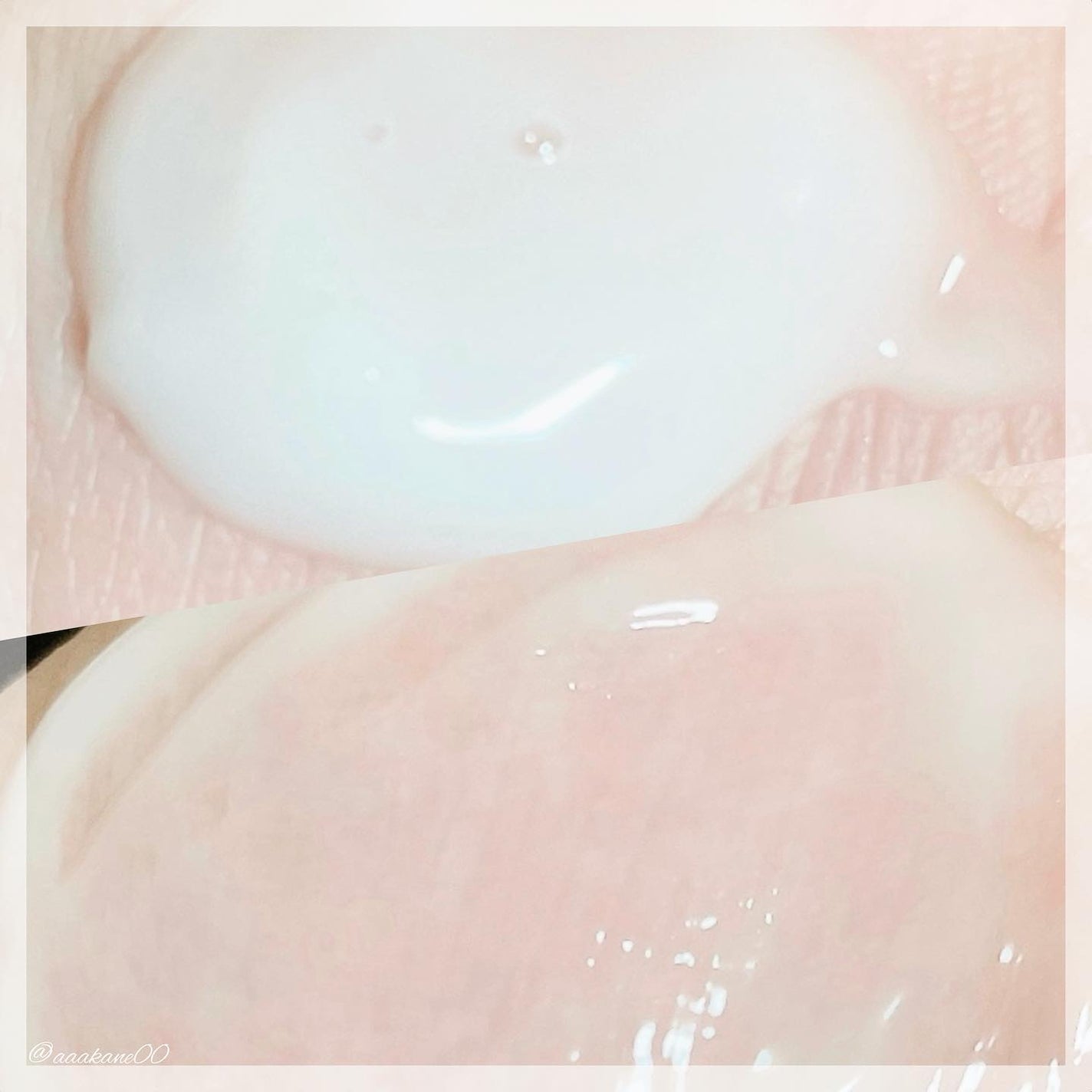 レッドブレミッシュ クリアスージングクリーム/Dr.G/フェイスクリームを使ったクチコミ(4枚目)