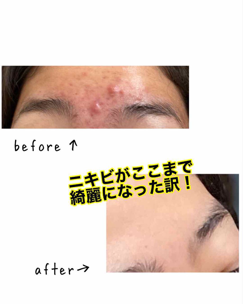 ã¯ãªãð»ð» on LIPS ããããã«æ©ãã§ãã10代ãžâ ïžããã¯ç§ã§ã¯ãããŸããâ ïžç§ã®åš..ãïŒ1æç®ïŒ