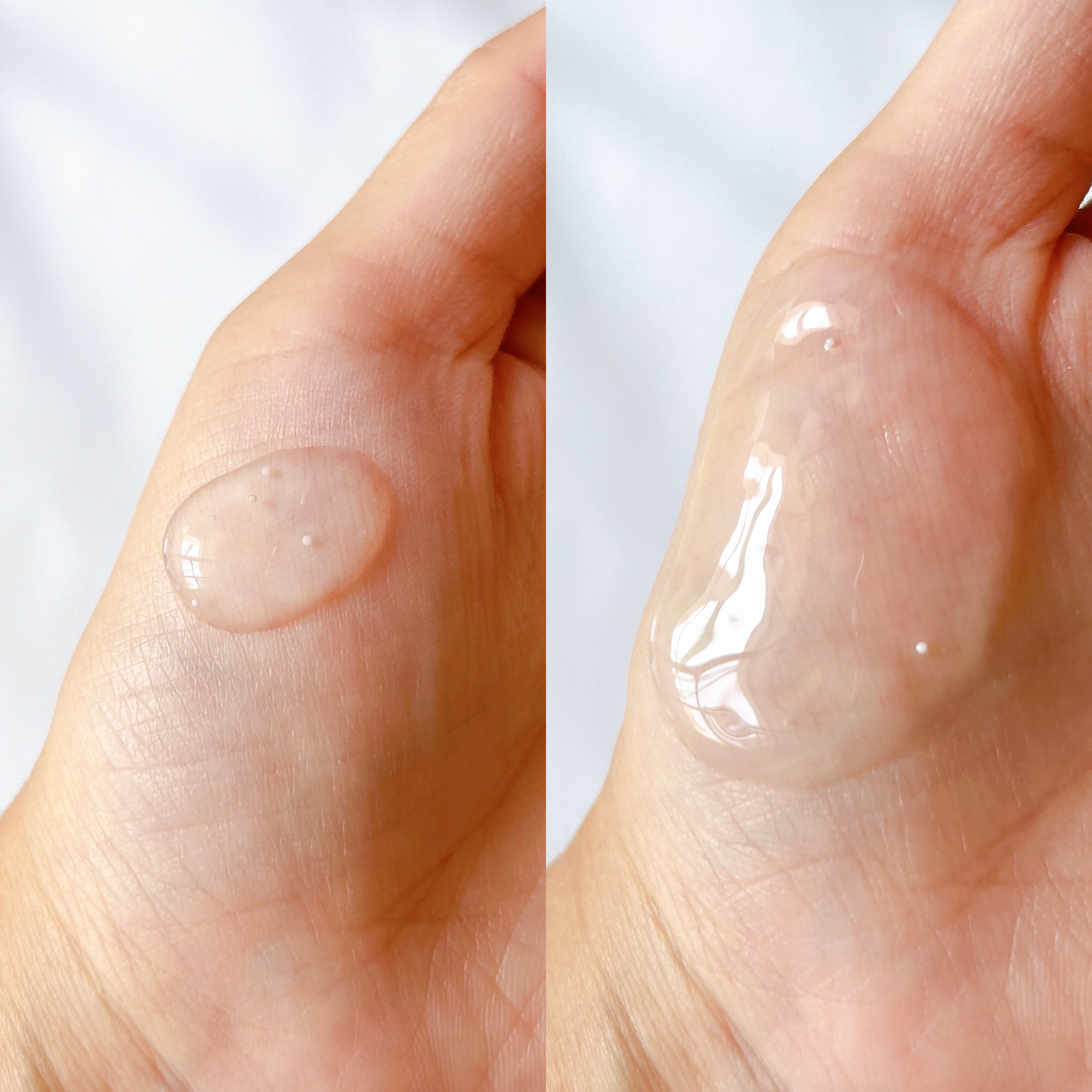 ナイアシンジンクビーズセラム/Frankly/美容液を使ったクチコミ（2枚目）