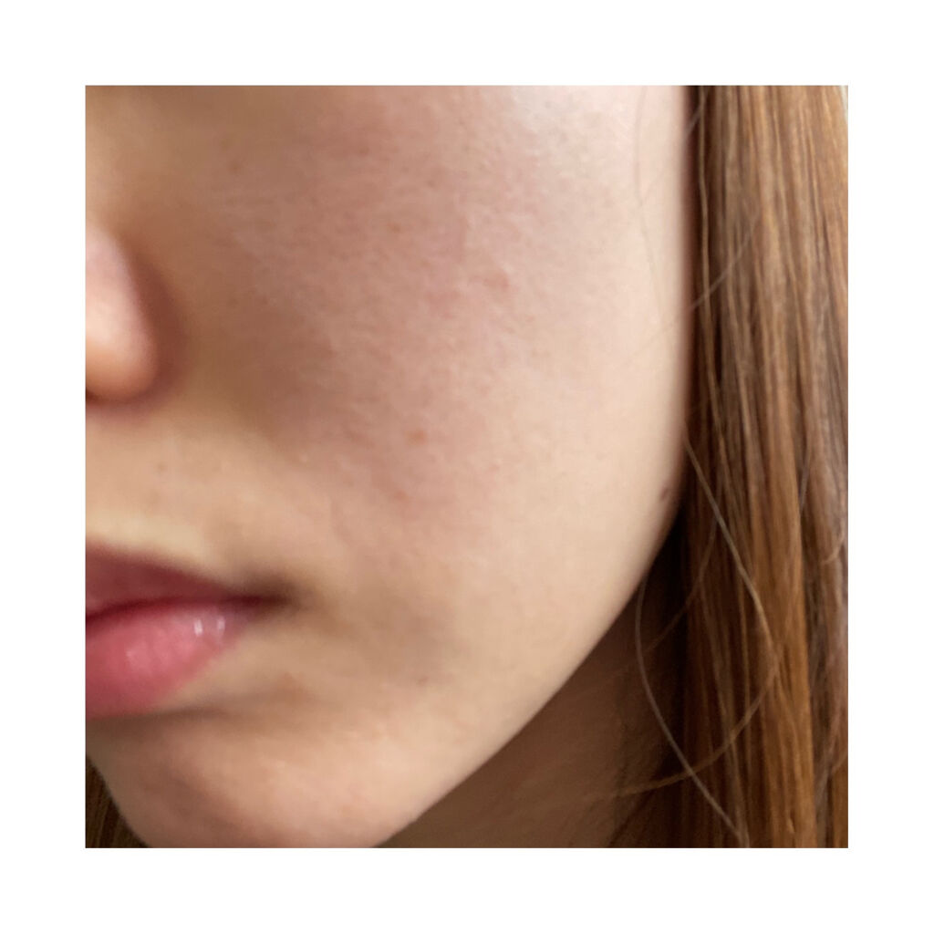 CELL CURE 4Tプラス/BELEGA/美顔器・マッサージを使ったクチコミ（1枚目）