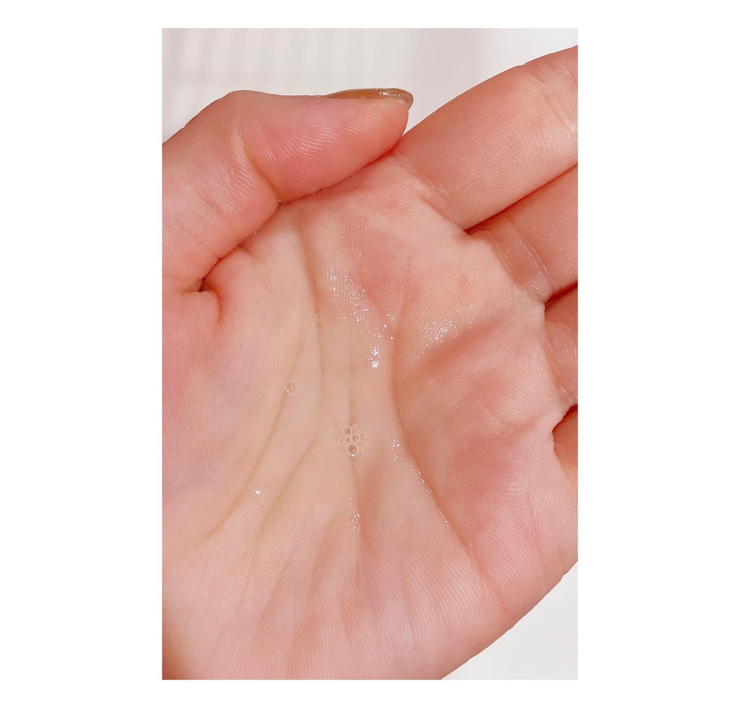 ミノン アミノモイスト 薬用アクネケア ローション/ミノン/化粧水を使ったクチコミ（2枚目）