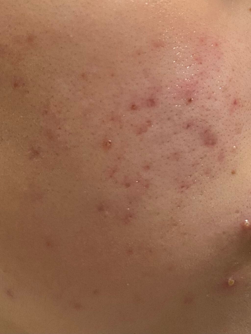 乳液・敏感肌用・高保湿タイプ/無印良品/乳液を使ったクチコミ(2枚目)