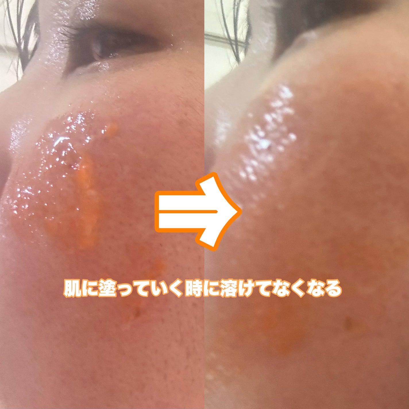 CPセラム A 美容液/カプセルセラム/美容液を使ったクチコミ(3枚目)