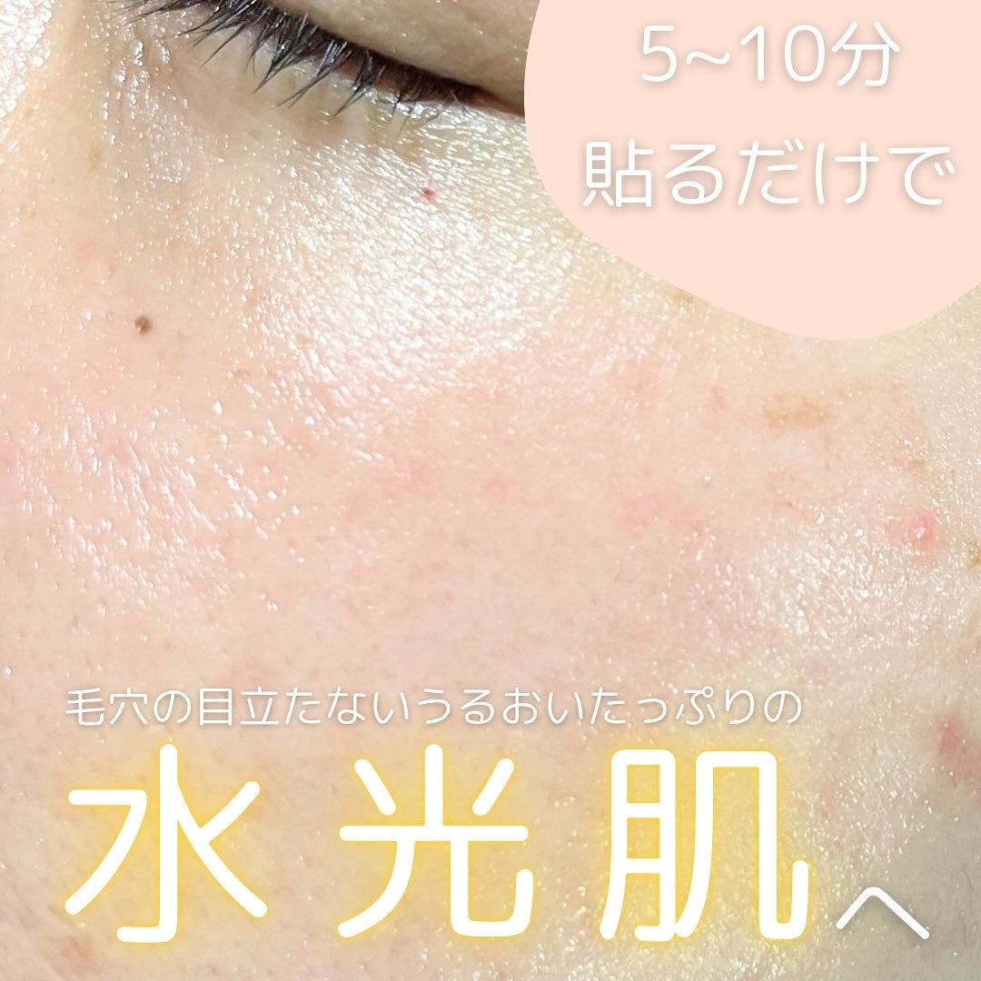 ルルルン ハイドラ V マスク/ルルルン/シートマスク・パックを使ったクチコミ(5枚目)