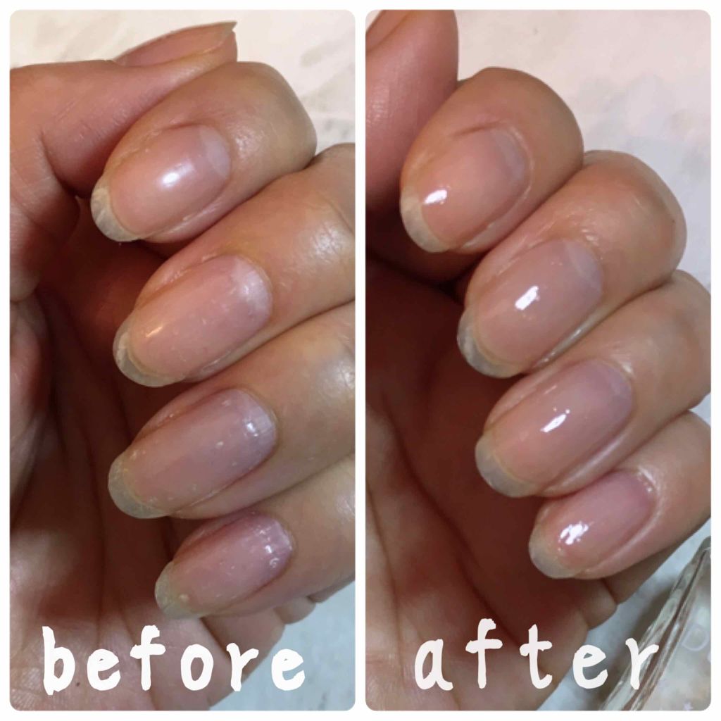 ベース＆トップコートⅡ/デュカート/ネイルトップコートを使ったクチコミ（2枚目）