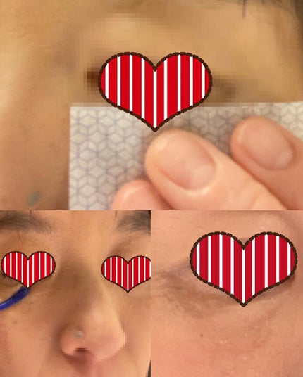 るいめい on LIPS 「.SHISEIDOビオパフォーマンスセカンドスキントライアルキ..」(5枚目)