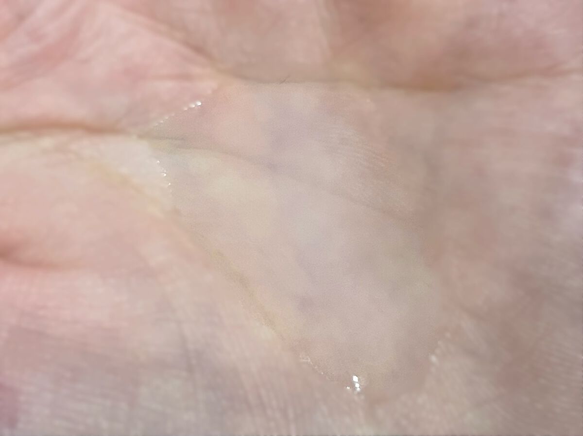 モイスト ローションC/リッツ/化粧水を使ったクチコミ(2枚目)