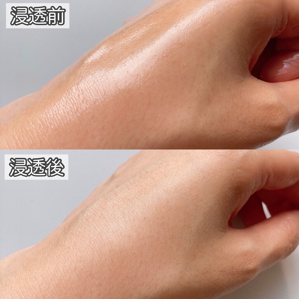 トラブルペアーマスク/DEWYCEL/シートマスク・パックを使ったクチコミ(5枚目)