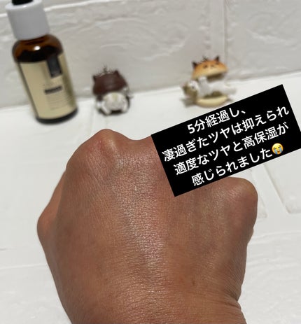 ダーマレーザー ウルセラC/クオリティファースト/美容液を使ったクチコミ(5枚目)