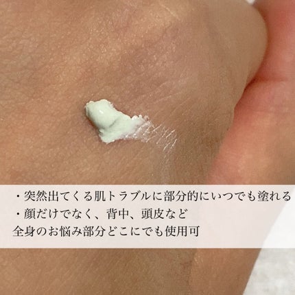 ミラクルアクネクリアスポットトリートメント/SOME BY MI/美容液を使ったクチコミ(5枚目)