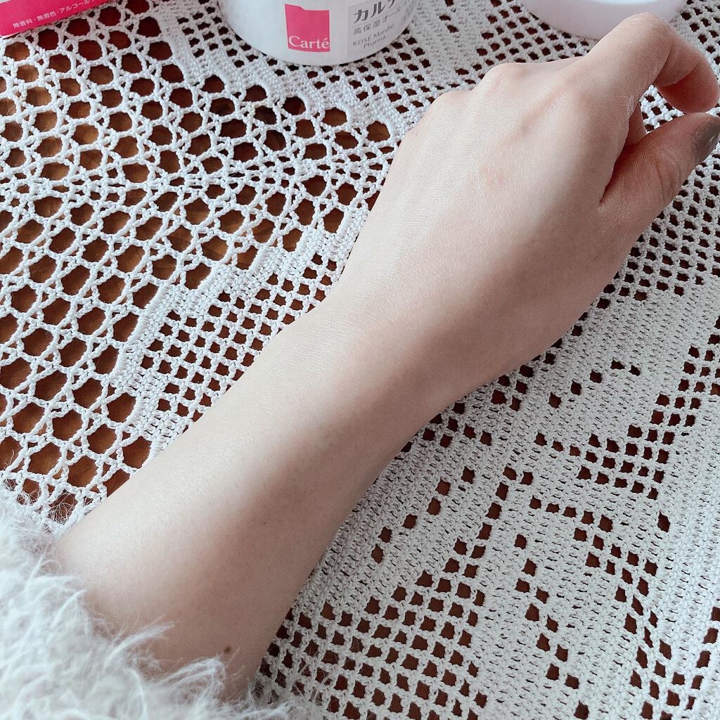 モイスチュア インストール/カルテHD/オールインワン化粧品を使ったクチコミ(5枚目)