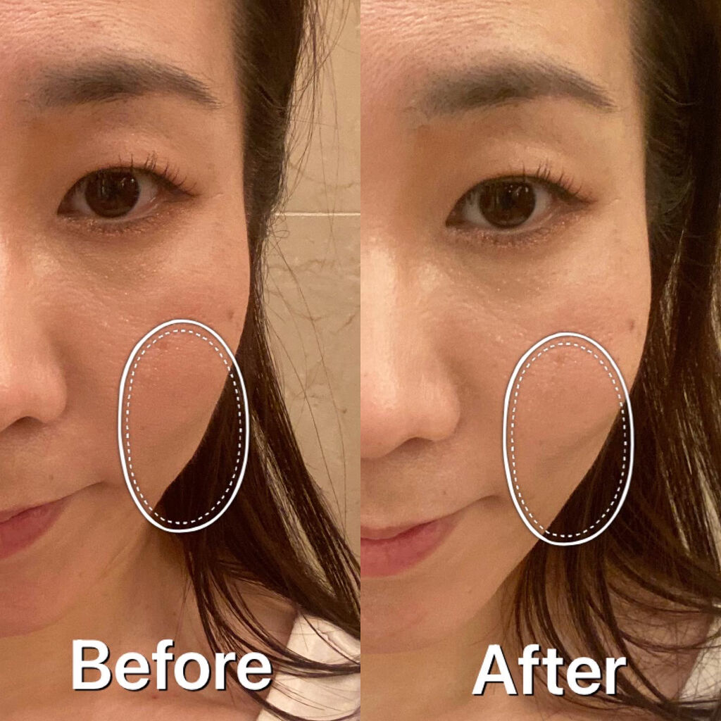 &be コントゥアペン/＆be/シェーディングを使ったクチコミ（3枚目）