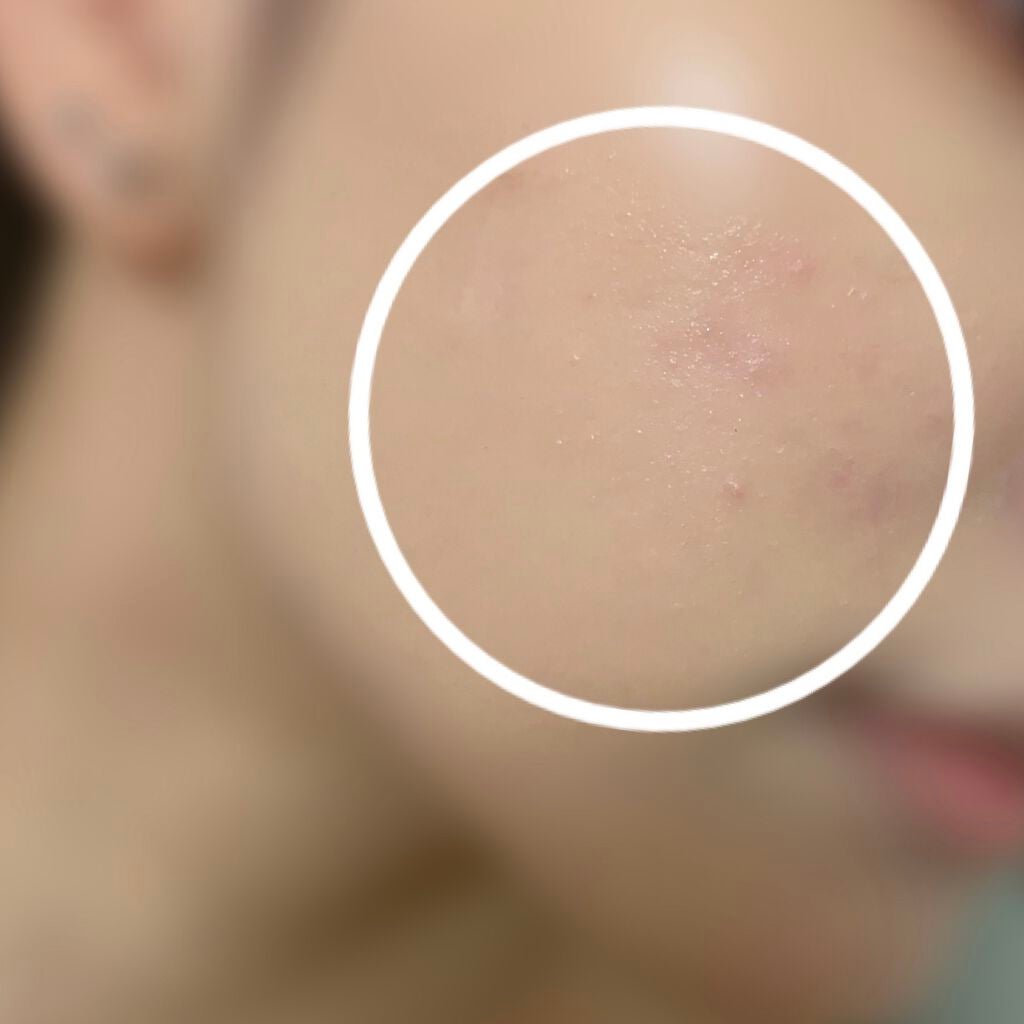 インテンシブ スキン セラム ファンデーション SPF40(PA++++)/BOBBI BROWN/リキッドファンデーションを使ったクチコミ(2枚目)