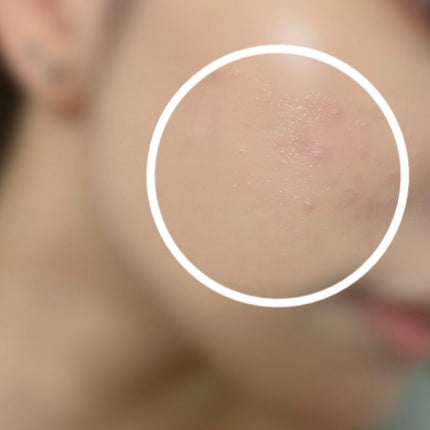 インテンシブ スキン セラム ファンデーション SPF40(PA++++)/BOBBI BROWN/リキッドファンデーションを使ったクチコミ(2枚目)