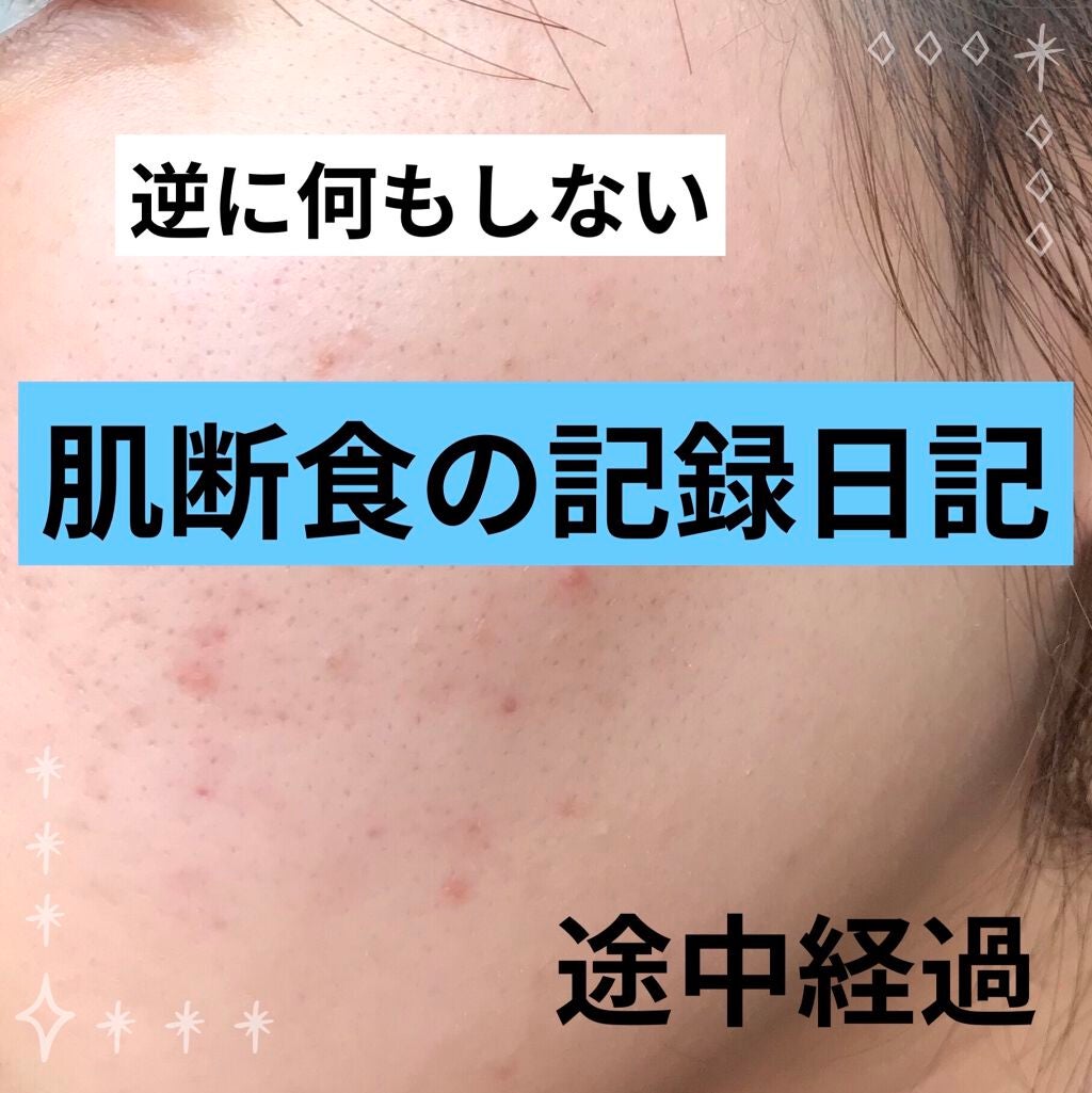 オリジナル ピュアスキンジェリー/ヴァセリン/ボディクリームを使ったクチコミ(1枚目)