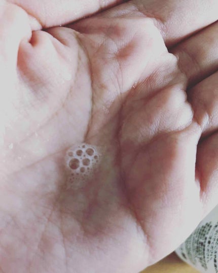 化粧水/2e/化粧水を使ったクチコミ(2枚目)