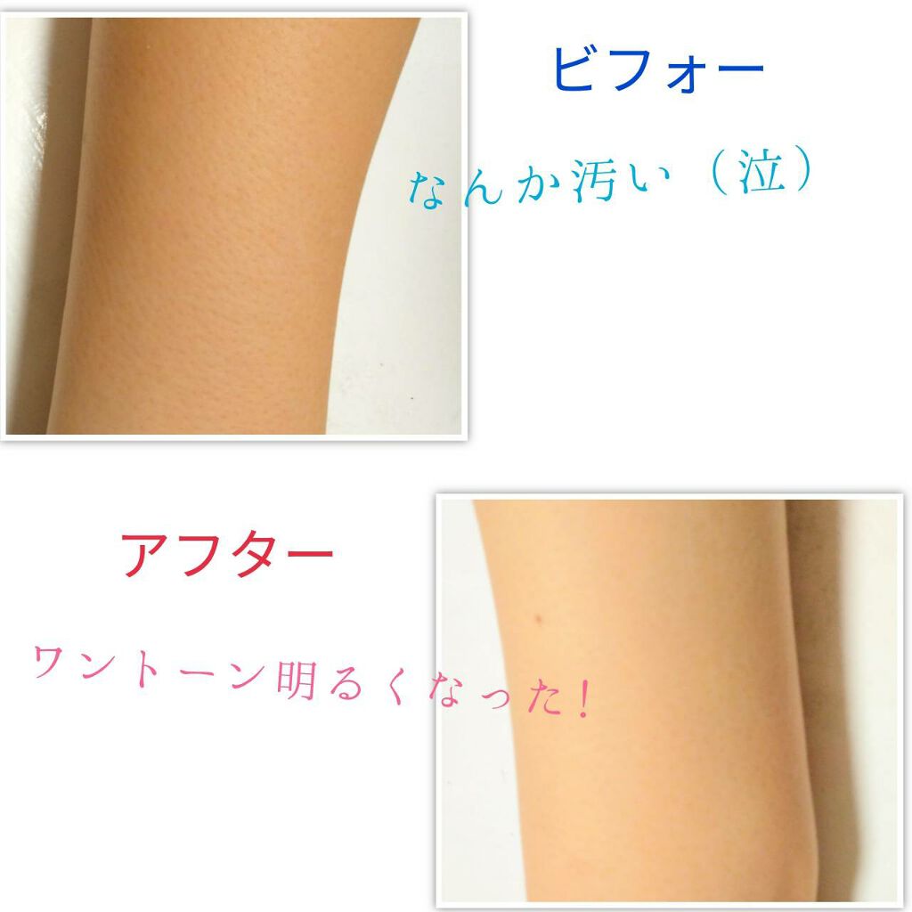  薬用美白化粧水/DAISO/化粧水を使ったクチコミ（2枚目）