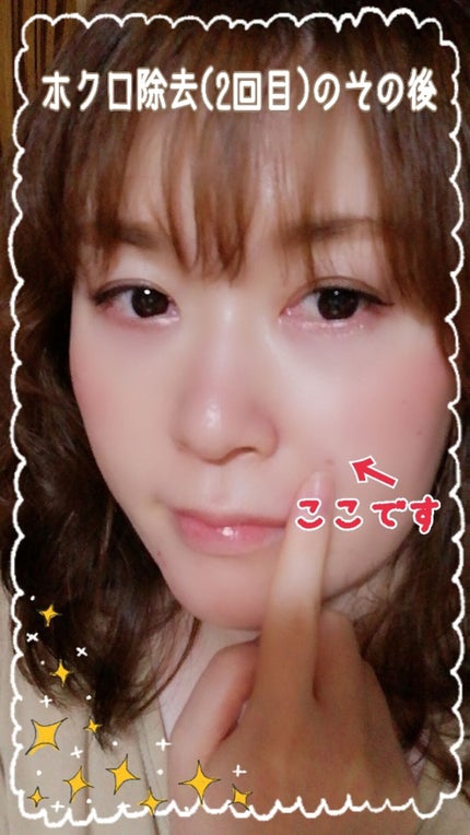 報告/その他を使ったクチコミ(1枚目)