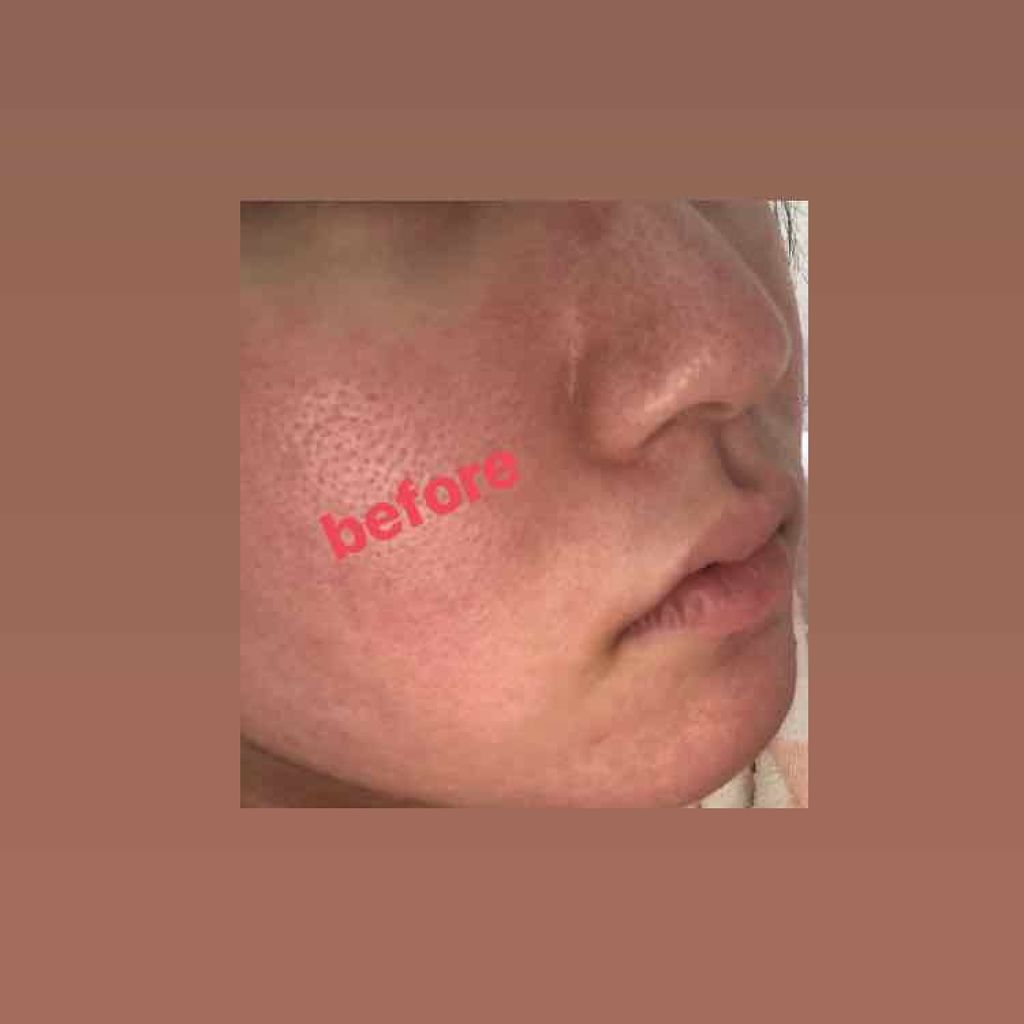 リフターナ 珪藻土パック/pdc/洗い流すパック・マスクを使ったクチコミ(2枚目)