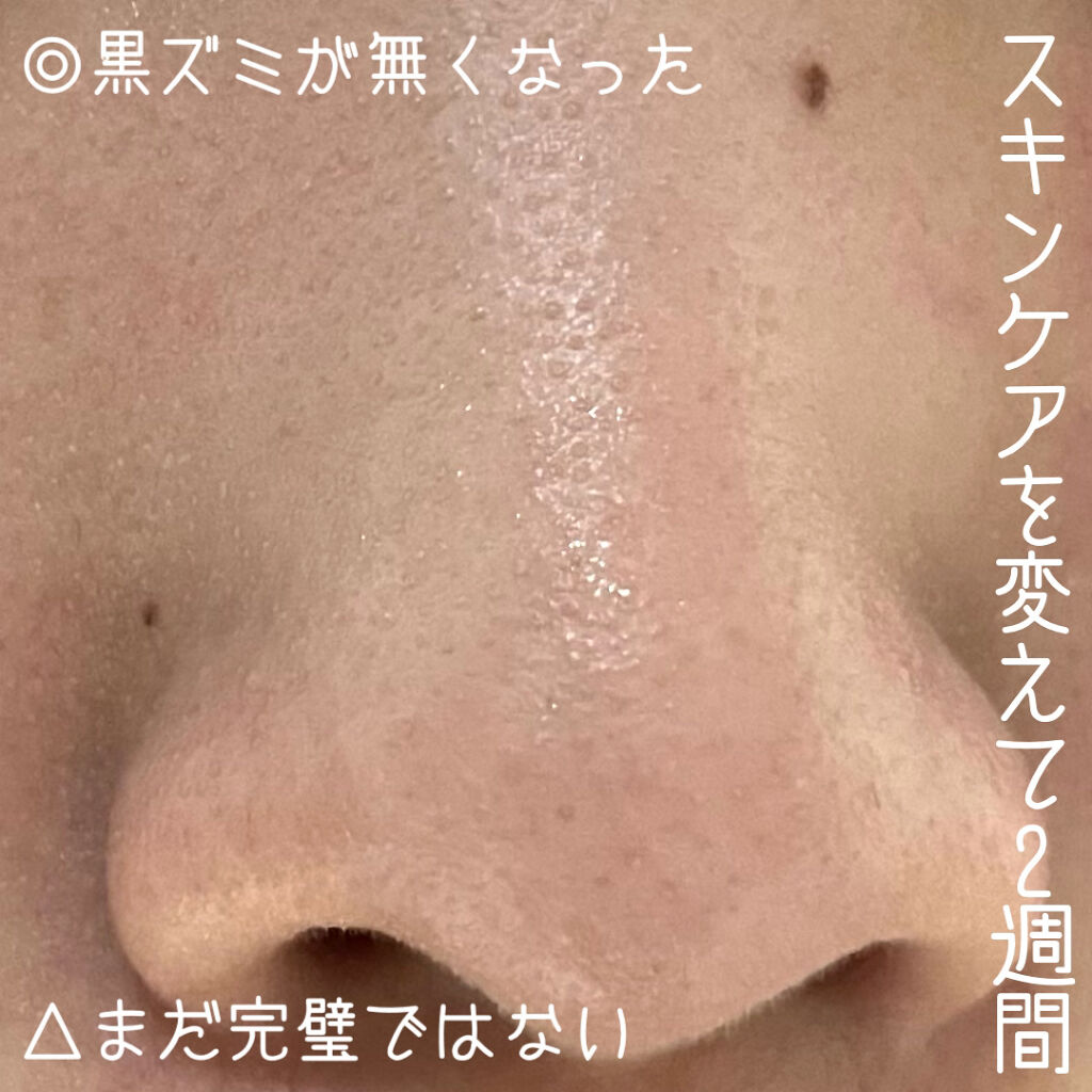 ザ・タイムR アクア/IPSA/化粧水を使ったクチコミ（3枚目）