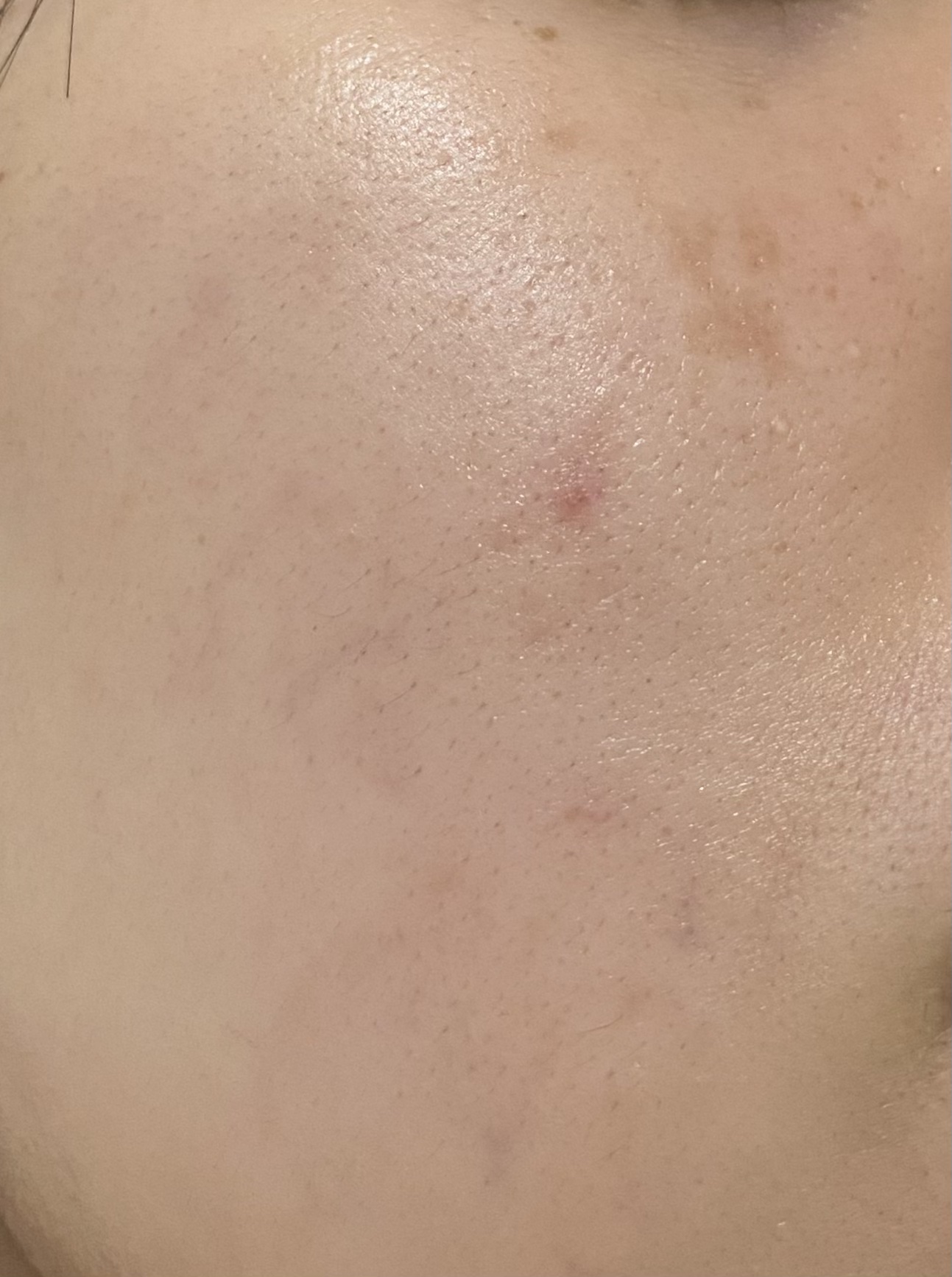 薬用Wホワイトエッセンス/透明白肌/美容液を使ったクチコミ（1枚目）