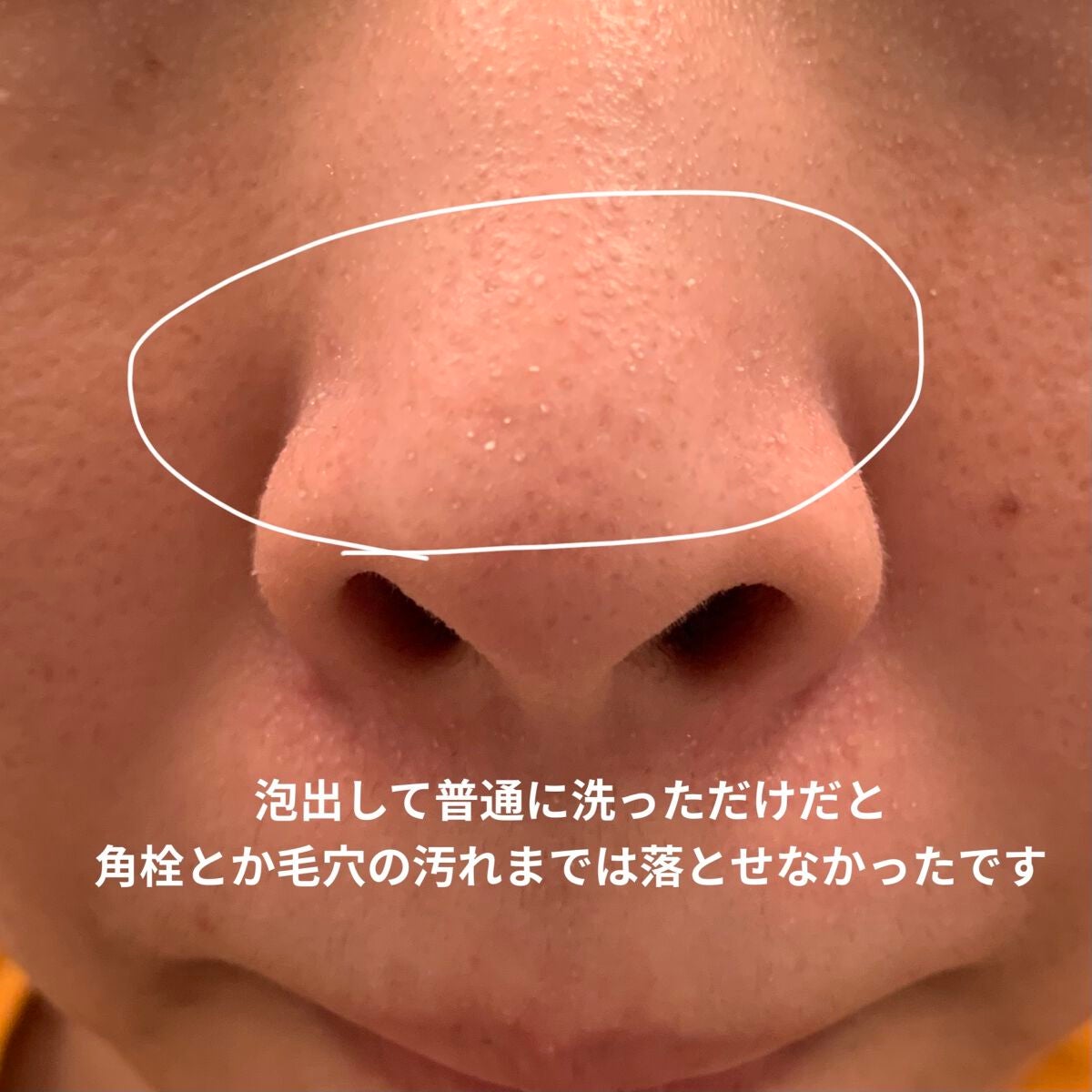 パフォーマンスツール トライアルセット/LOGIC/トライアルキットを使ったクチコミ(5枚目)