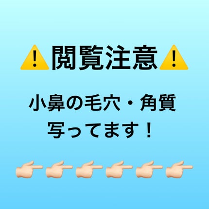 アップルミント AHA・BHA 10%リキッド/goodal/化粧水を使ったクチコミ(4枚目)