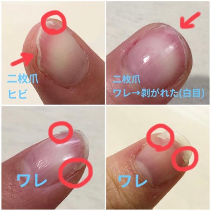 オイルインキューティクルプッシャーペン/ビューティーワールド/ネイル用品を使ったクチコミ(3枚目)