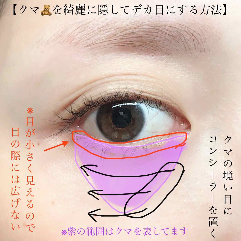 フローレス フィット/COVERMARK/クリーム・エマルジョンファンデーションを使ったクチコミ(3枚目)