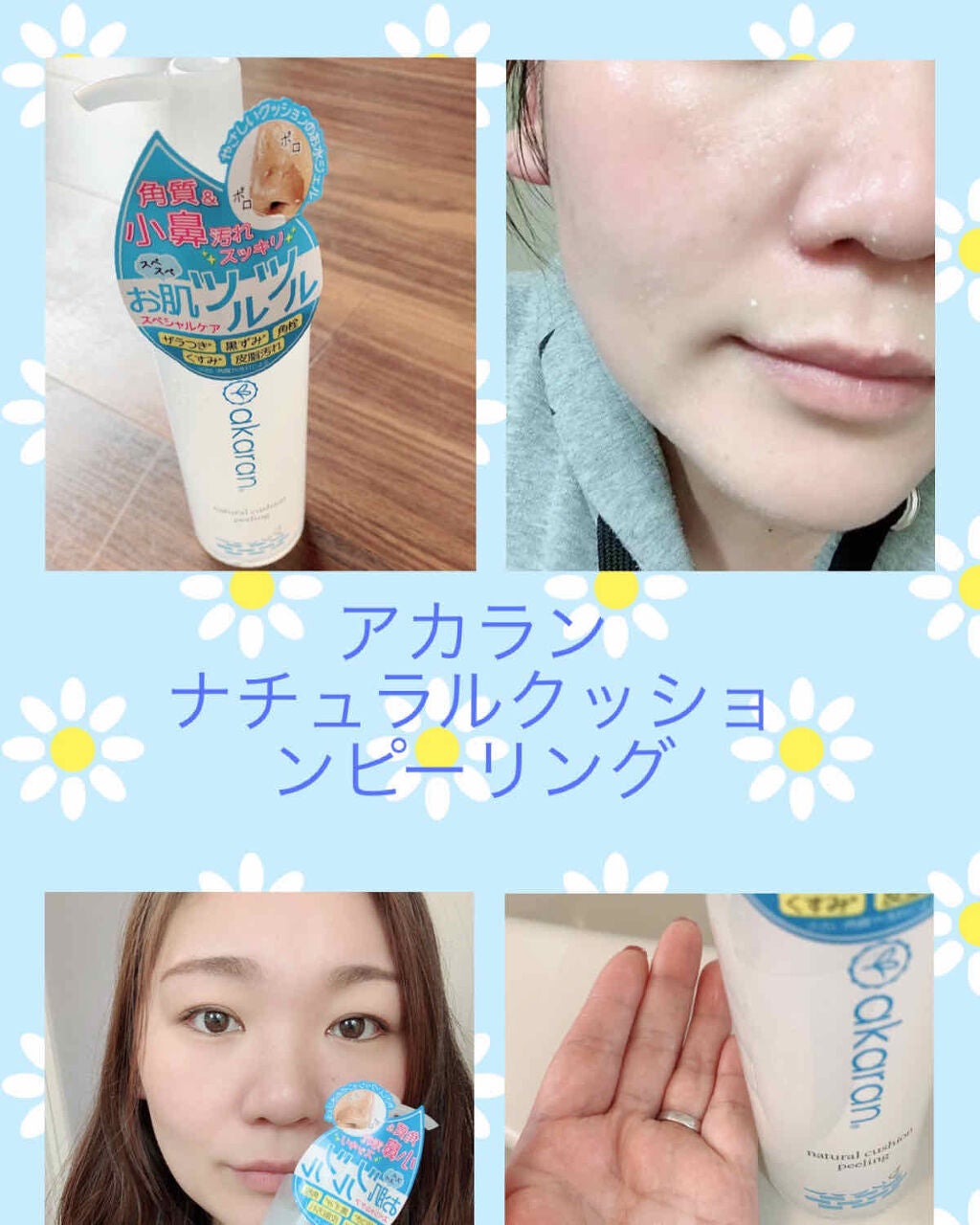ナチュラルクッションピーリング/アカラン/ピーリングを使ったクチコミ(1枚目)