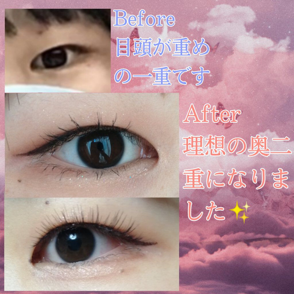 オリシキ アイリッドスキンフィルム		/D-UP/二重まぶた用アイテムを使ったクチコミ（2枚目）