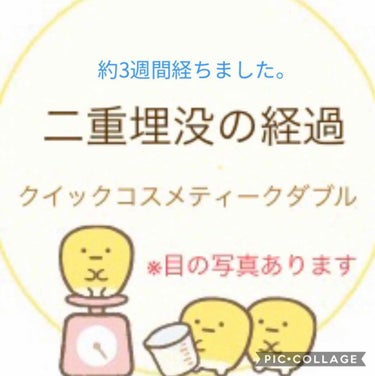 ぬこた on LIPS 「かなり二重も安定してきました。①整形前の画像と比較②カラコンす..」（1枚目）